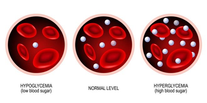 hypoglycemia