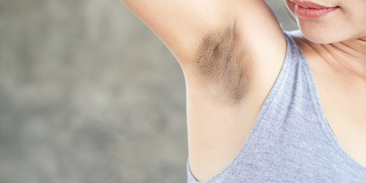 Asian woman having skin problem with black armpits