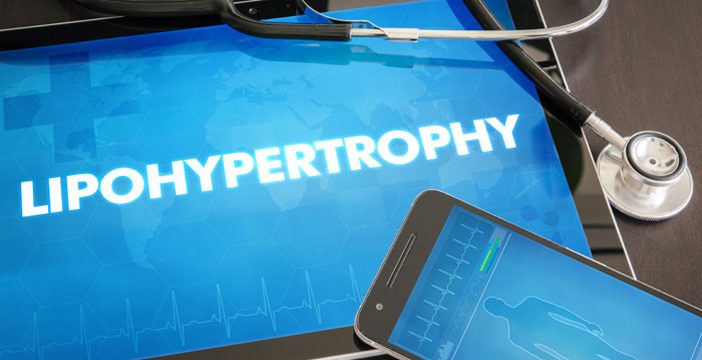 liophypertrophy